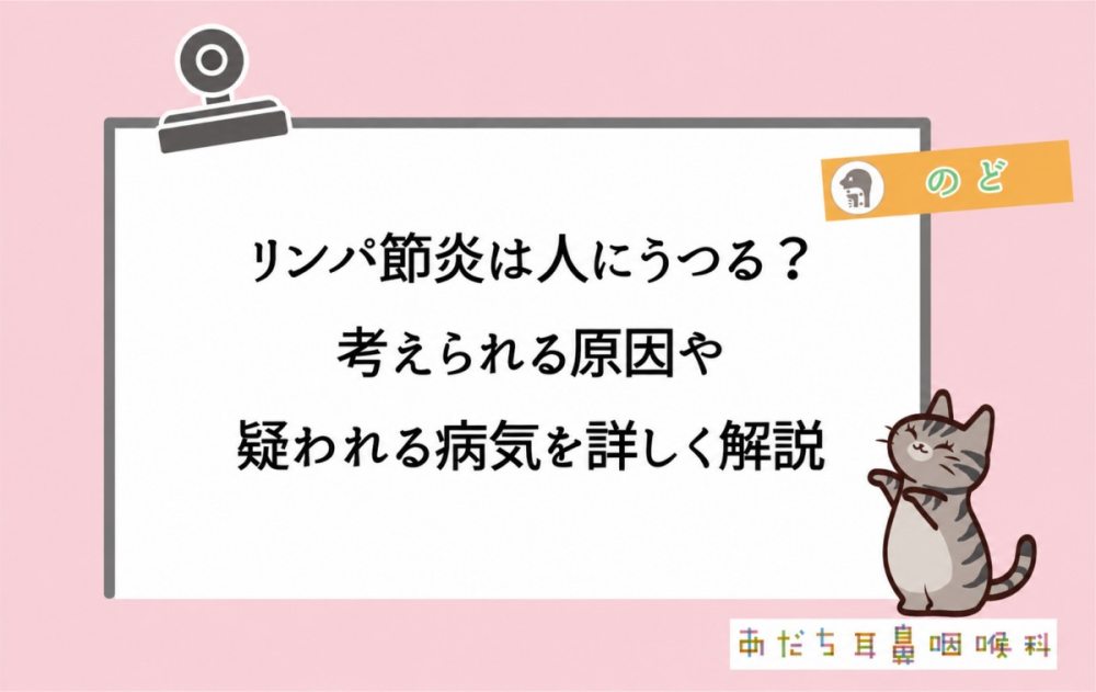 リンパ節炎は人にうつる？考えられる原因や疑われる病気を詳しく解説
